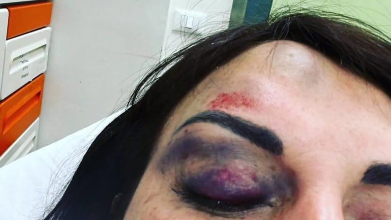 Divieto di avvicinamento per l'ex di Francesca De André dopo le aggressioni