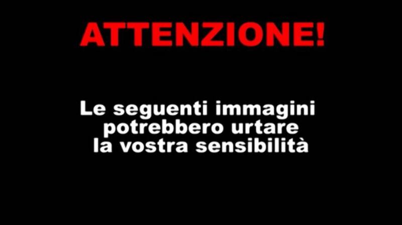 Le foto choc del poliziotto ferito da un bullone 1