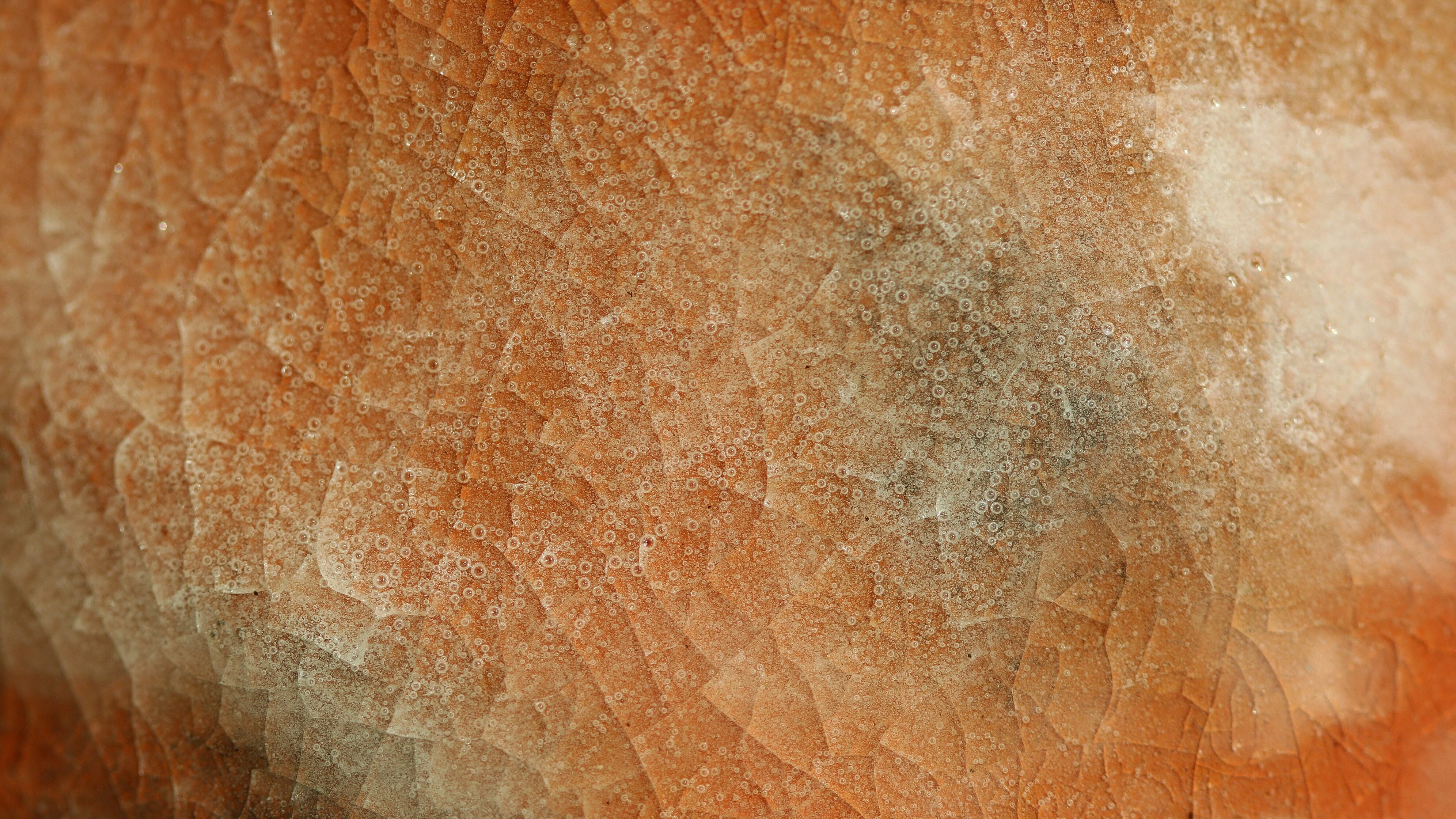 Come proteggersi dal melanoma, uno dei tumori maligni più diffusi