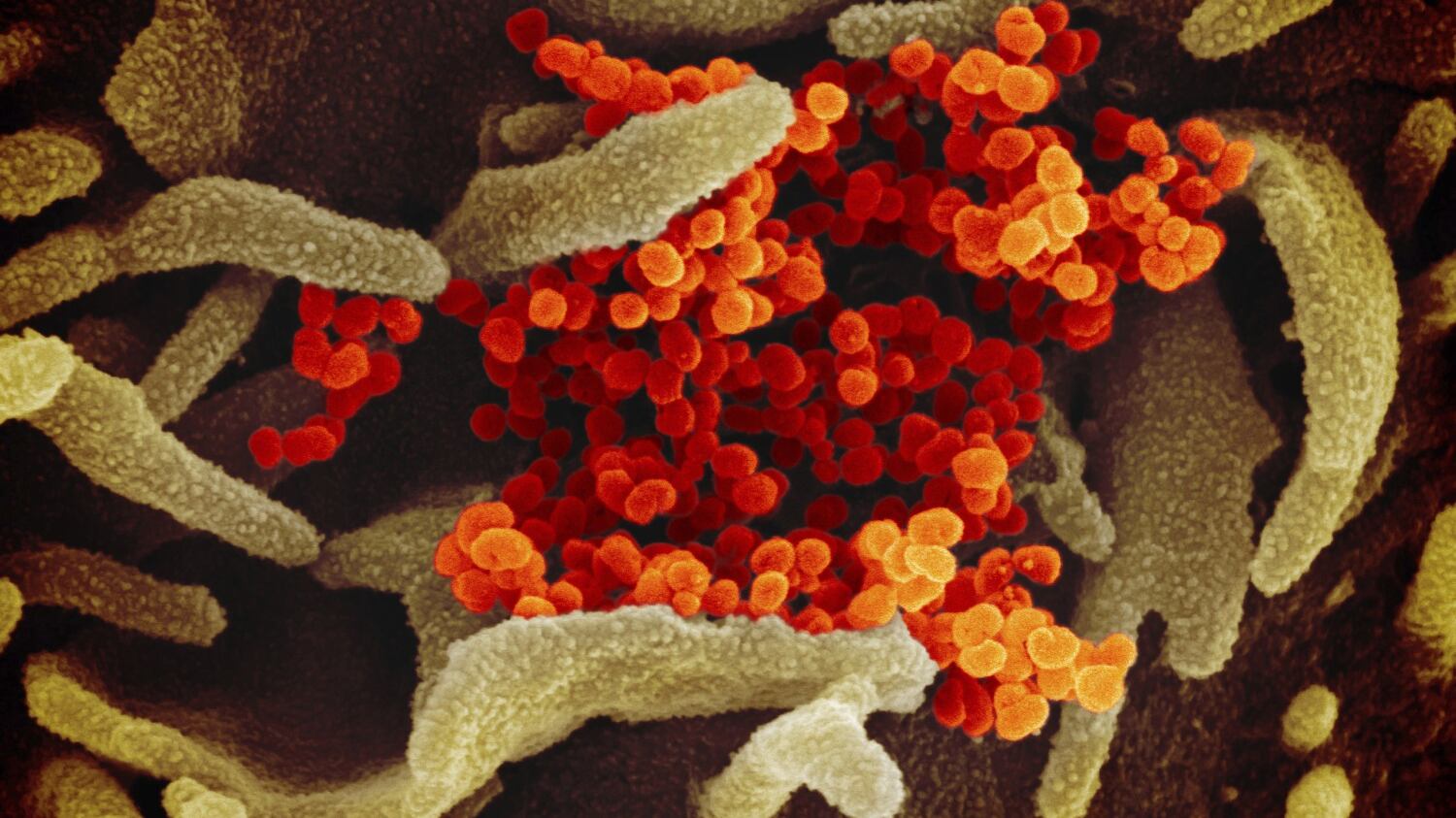 Creata la mappa in 3D di proteina coronavirus: vaccino sempre più vicino