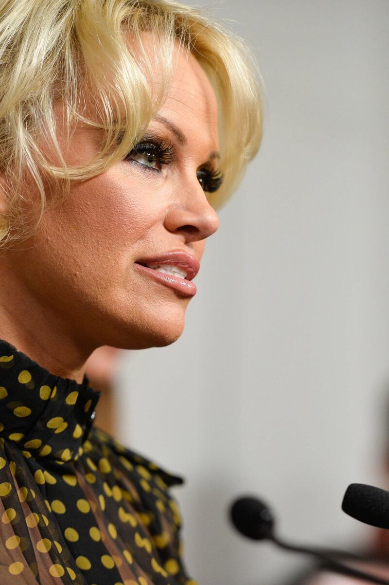 Pamela Anderson contro il foie gras 26