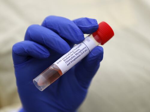 Coronavirus, infusioni di plasma dei guariti per curare i contagiati