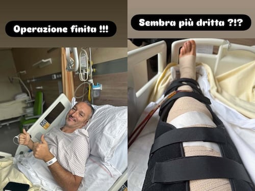 "Sembra più dritta?": Zambrotta operato alle gambe, come sta l'ex calciatore