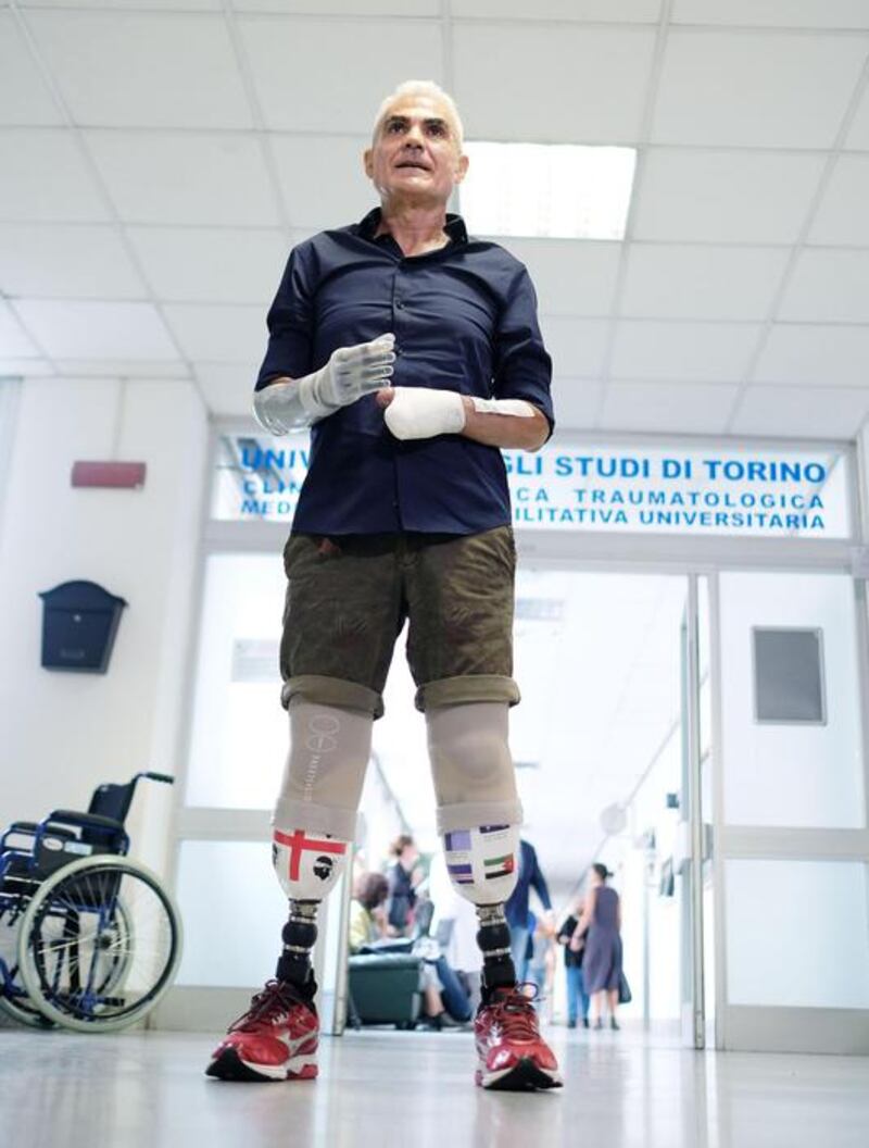 Zanda con le protesi, pronto per tornare a correre