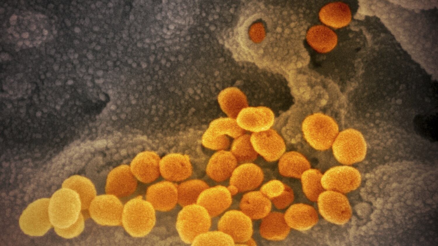 Covid-19, gli scienziati ancora a caccia dell'animale "untore"
