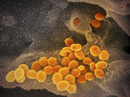 Covid-19, gli scienziati ancora a caccia dell'animale "untore"