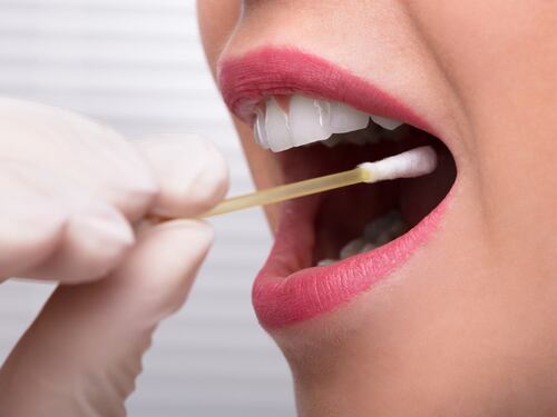 3 cose da sapere sul test diagnostico salivare per l'endometriosi