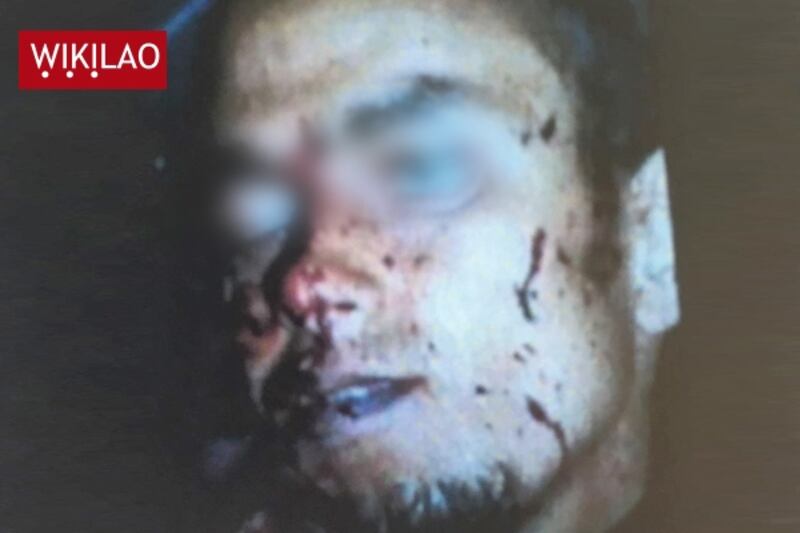 La foto del cadavere di Mohamed Lahouaiej Bouhlel 2