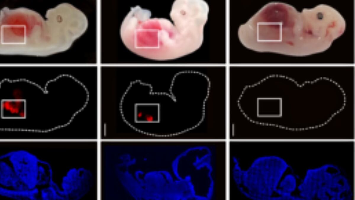 Creati i primi reni embrionali umanizzati. Un passo avanti nel trapianto di organi