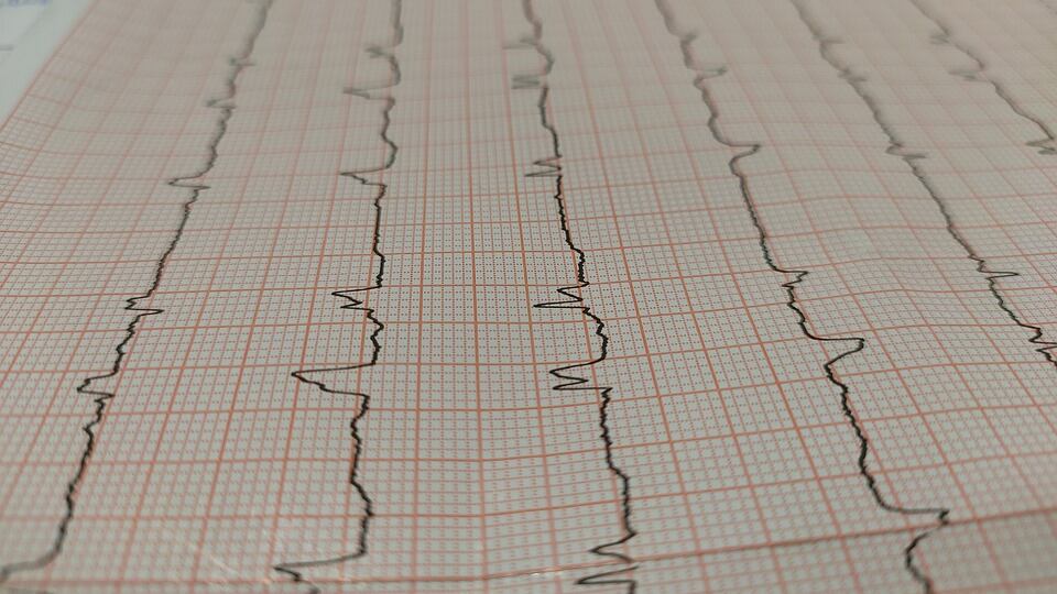 Infarto, qual è la proteina che "ripulisce" le arterie del cuore