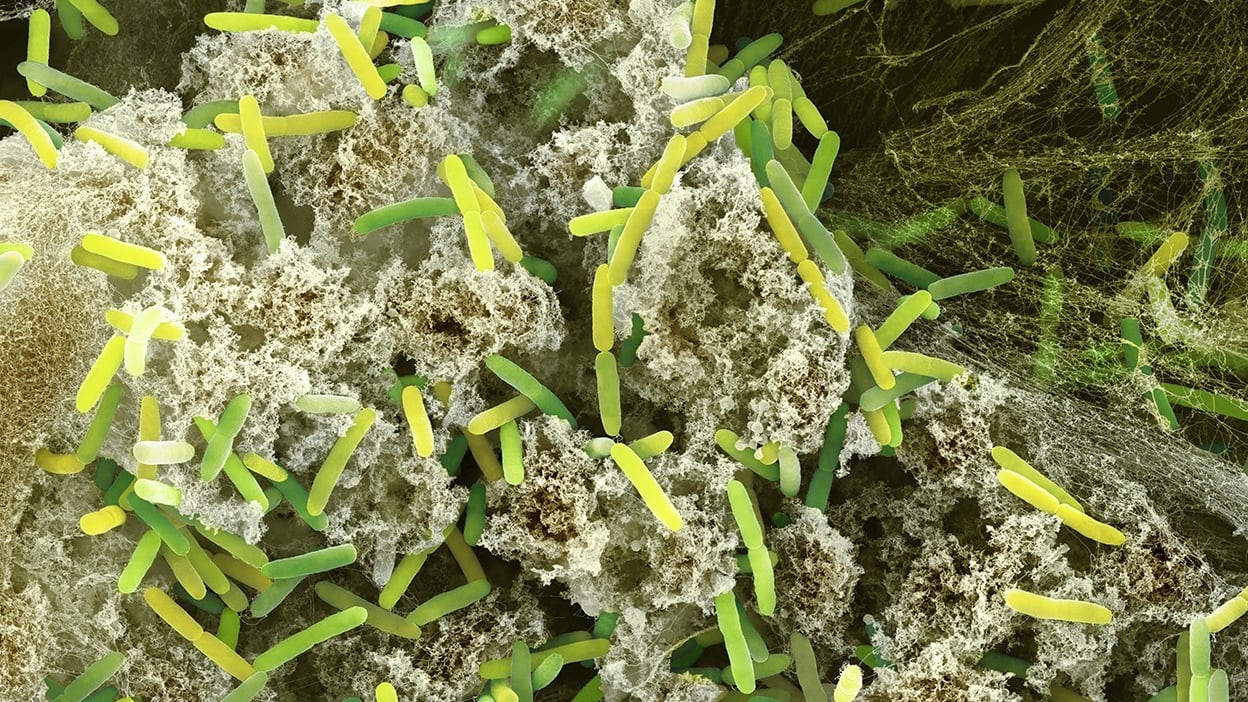 Incubo listeria, l'esperto: "Ecco a cosa fare attenzione"