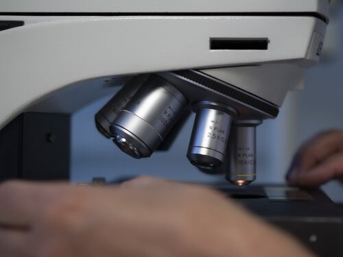 Tumori aggressivi, meno movimento delle cellule limita le metastasi