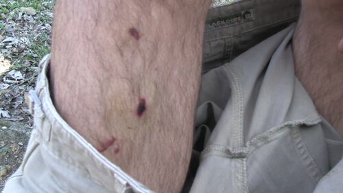 I lividi di Pino Di Lella 3