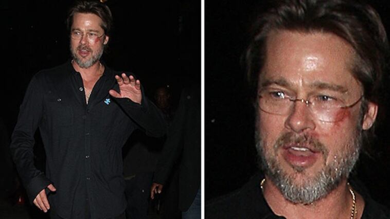 Brad Pitt all'evento di beneficenza con un occhio nero