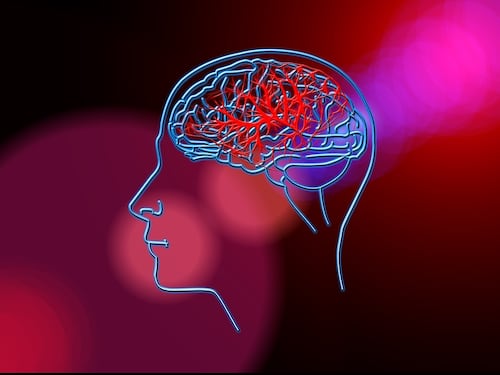 Ictus cerebrale, come prevenirlo