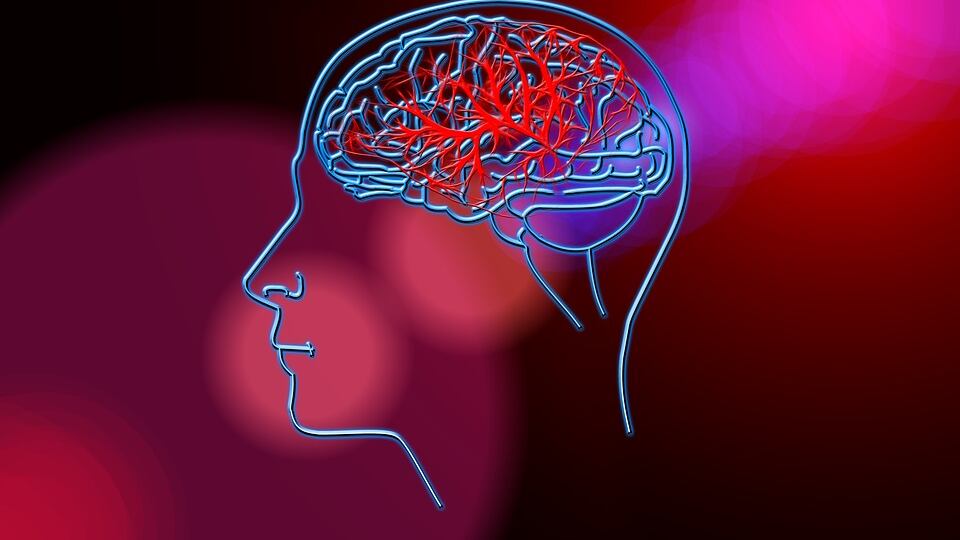 Ictus cerebrale, come prevenirlo