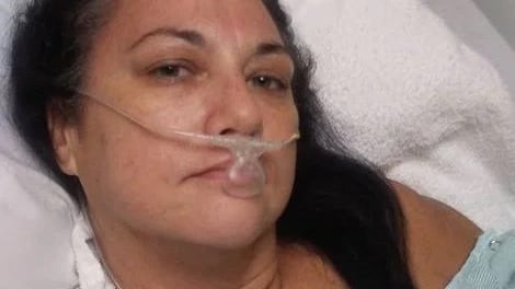 Hawaii, donna si taglia con carta: l'infezione rischia di ucciderla