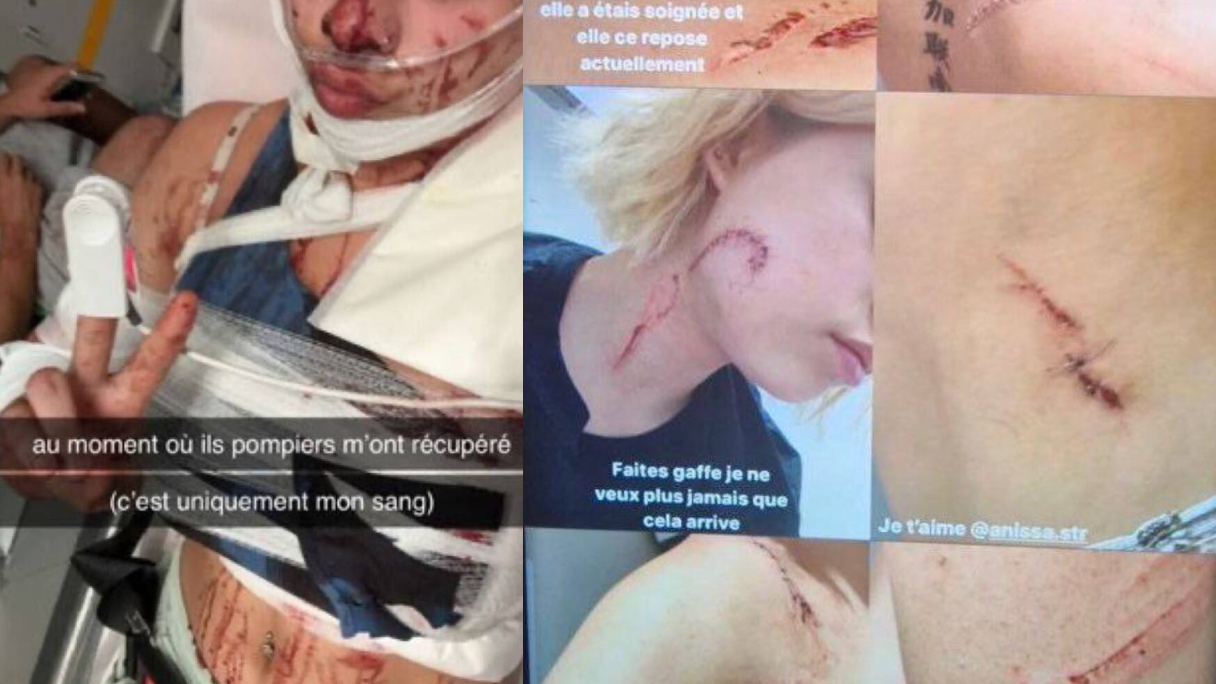Sfigurata da quattro magrebini perché il suo abbigliamento è "immorale"