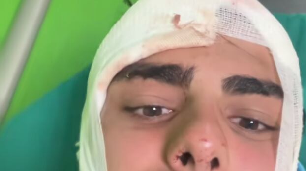 Alessandro, aggredito a Milano per un orologio: "Preso a martellate in testa. Ho rischiato di morire"