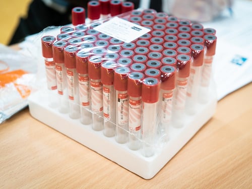 Lombardia, al via il 23 aprile dei primi test sierologici