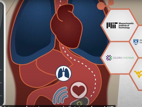 Pillola "smart" per monitorare i segnali vitali: come funziona