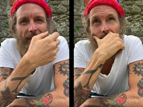 Jovanotti a 4 mesi dall'incidente: "Uso ancora le stampelle, i muscoli fanno male"