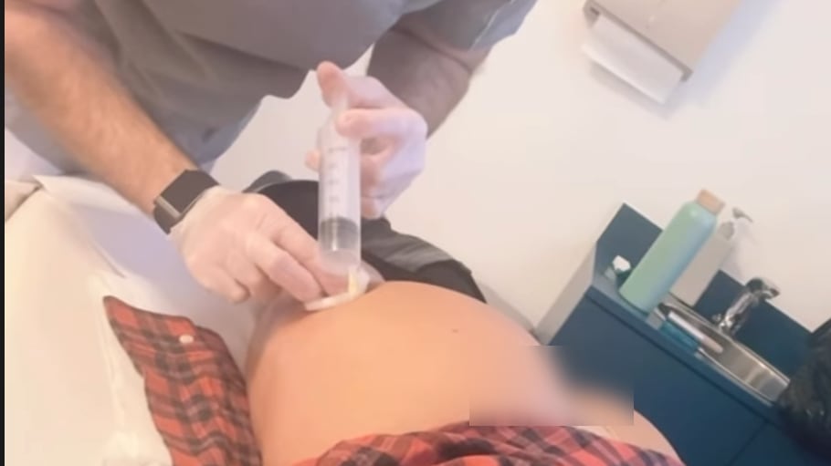 Belen mostra il fondoschiena e i risultati dell’ozonoterapia: la foto che fa impazzire il web
