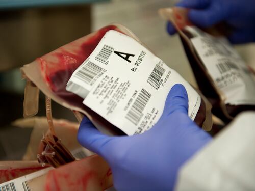 Anemia mediterranea, quali sono i sintomi?