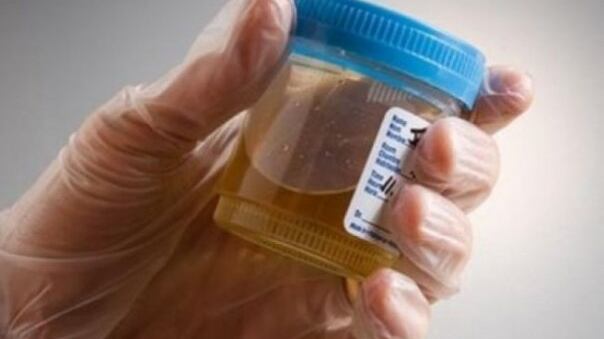Rimini, medico usa la sua pipì per coprire la paziente drogata
