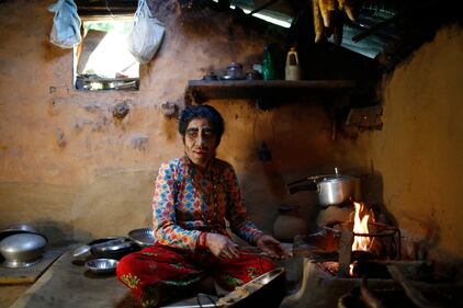 Nepal, soffrono di una malattia che li rende pelosissimi 7