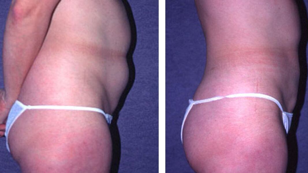 Quell'approccio più «soft» per ridefinire la silhouette