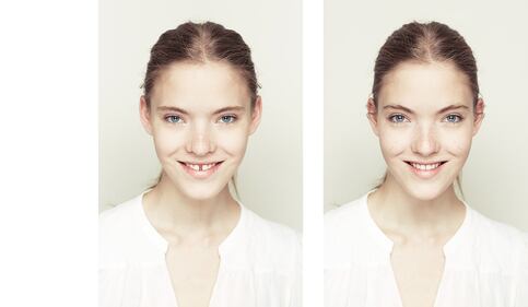 Il profilo migliore: le fotografie che raddoppiano solo una metà del volto 1