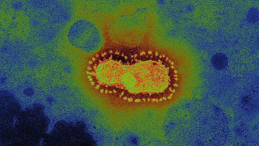 Coronavirus, anche il cortisone fra i farmaci che lo combattono