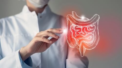 malattia Crohn