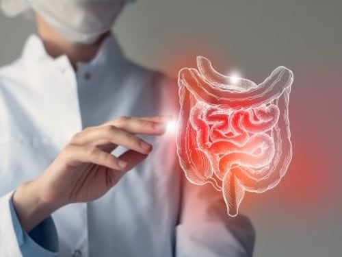 MICI, la prevenzione parte dagli stili di vita e dalla diagnosi precoce