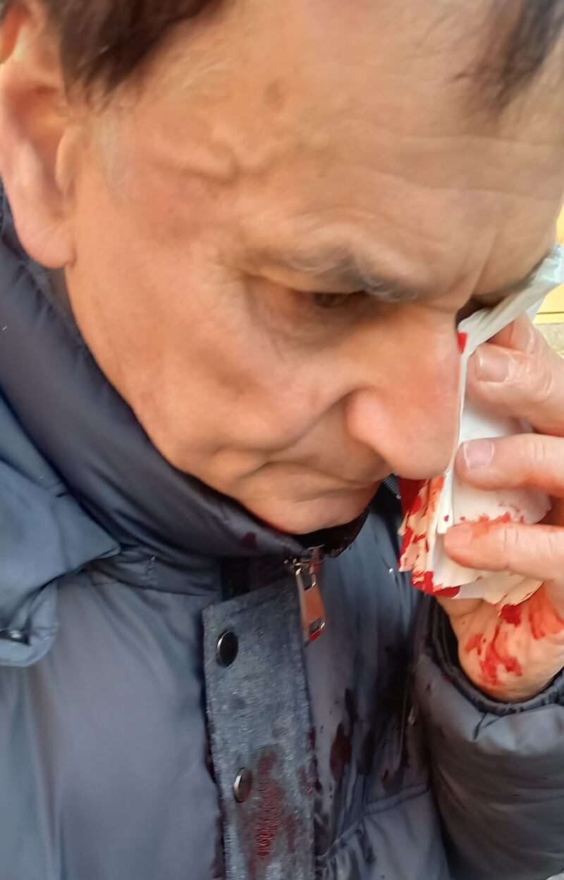 Militante leghista aggredito a Bergamo