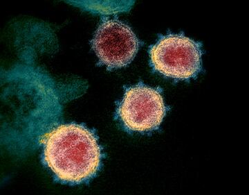 Le nuove immagini del coronavirus 1