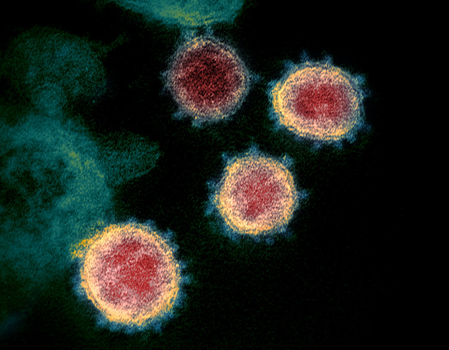 Le nuove immagini del coronavirus