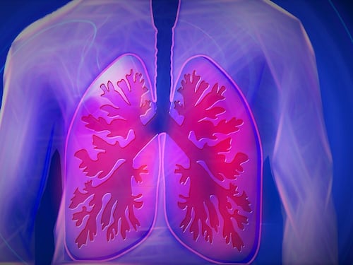 Torino, trapiantati quattro organi a paziente con fibrosi cistica