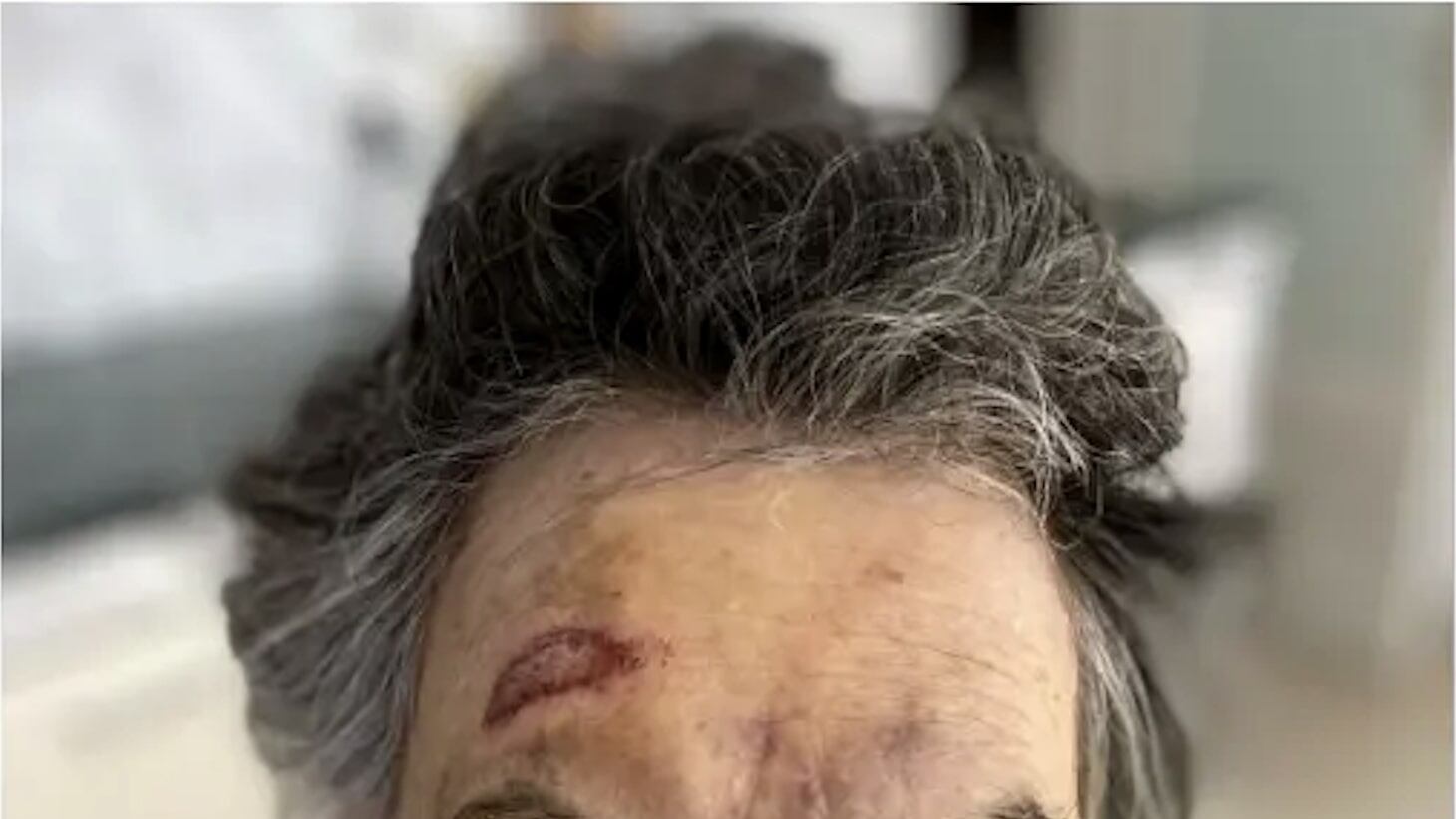 Nega l'elemosina a un senzatetto, lui pesta l'83enne con la stampella