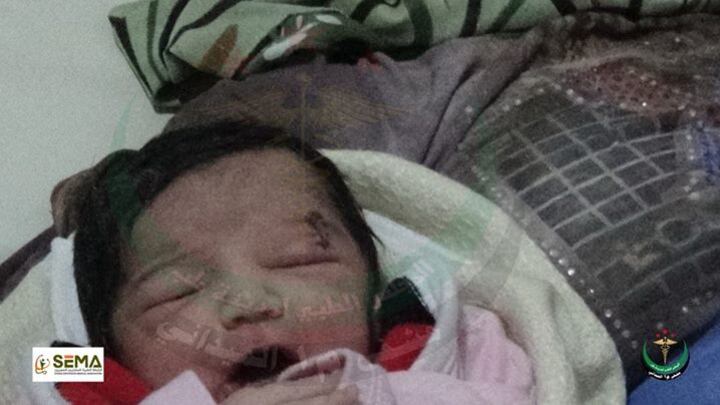 Siria, una neonata viene al mondo già "colpita" dalla guerra civile