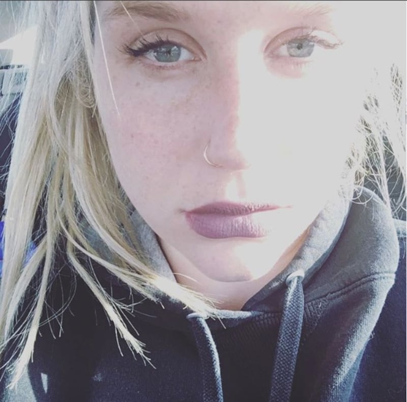 L'appello di Kesha alle donne: "Se subite abusi perlate" 5
