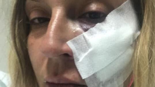 "Ho sentito rompersi i denti". Così Beatrice è stata aggredita
