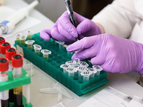 Linfoma di Hodgkin, ecco come il cancro manipola le cellule immunitarie