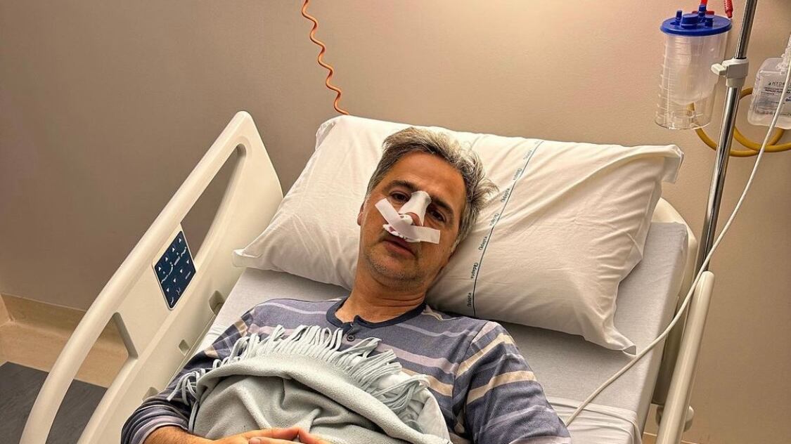 L'incidente poi le operazioni. Beppe Convertini: "Faccia completamente distrutta"