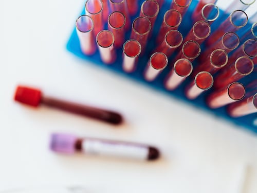 Tumori del sangue, identificato un nuovo metodo per prevenirli