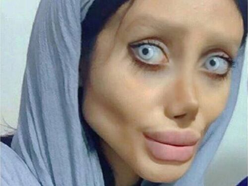 Tre anni, cinquanta interventi per somigliare a Angelina Jolie