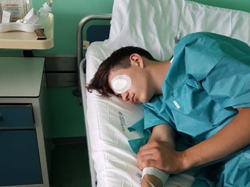 Lanciano, 17enne pestato dal branco rischia di perdere un occhio