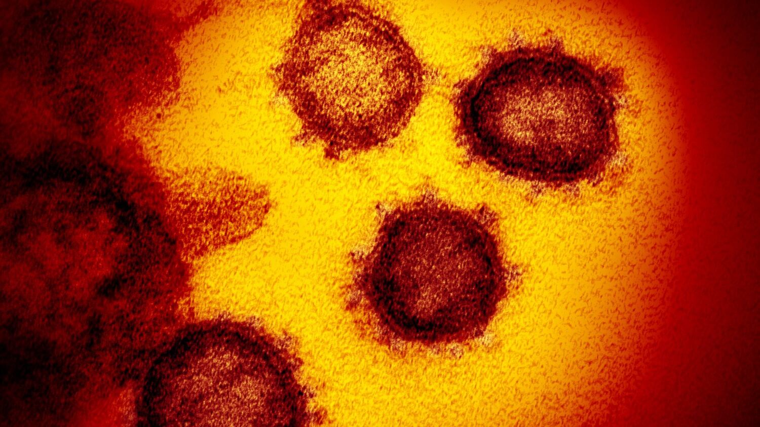 L'esperto di studi strategici: "Così ci si difende dai virus"