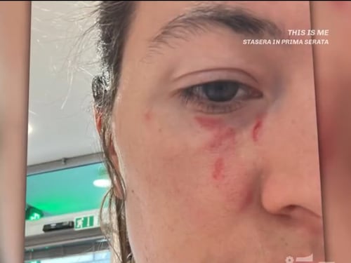 I colpi al volto, il selfie e i coltelli del killer: la violenza di Soncin contro Pamela. Il gip: "Resti in carcere"